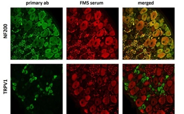 Nicht nur eine Reaktion, sondern die Ursache