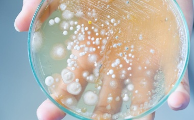 Leitlinie für Umgang mit invasiven Pilzinfektionen durch Candida