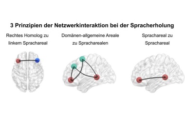 Neue Erkenntnisse zu Mechanismen der Spracherholung nach Schlaganfall
