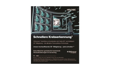 Workfloweffizienz und KI-Integration in der Mammadiagnostik