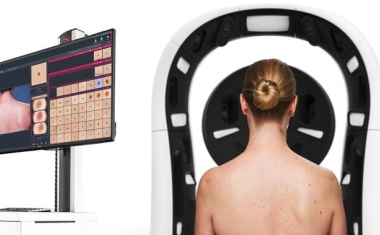 KI-Diagnoseplattform verbessert Früherkennung von Hautkrebs