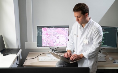 Mechanismen der Krebsmetastasierung mit KI entschlüsseln