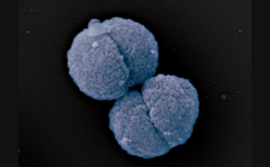 Neue Antibiotika gegen Problemkeime