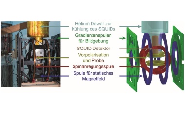 Neuartige Methoden erweitern MRT-Portfolio