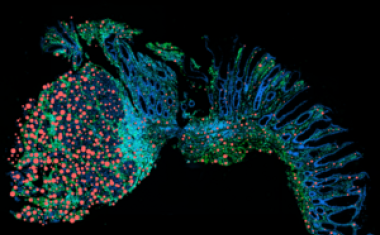 Damit aus chronischer Entzündung kein Krebs wird
