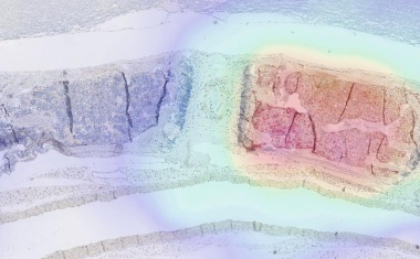 Wie sich Immunzellen im Körper verfolgen lassen