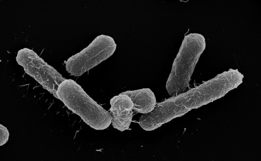 Multiresistente Darmbakterien: Verdrängung durch Nahrungskonkurrenz