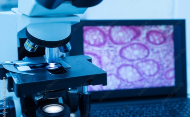 Neue Methode zur Protein-Analyse