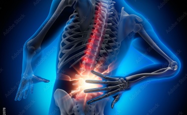 KI verbessert Diagnose chronischer Rückenschmerzen