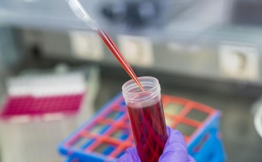 Bauchspeicheldrüsenkrebs frühzeitig erkennen