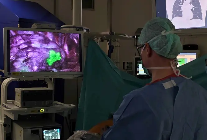KI-3D-Planung und ICG-Markierung bei Lungenkrebs