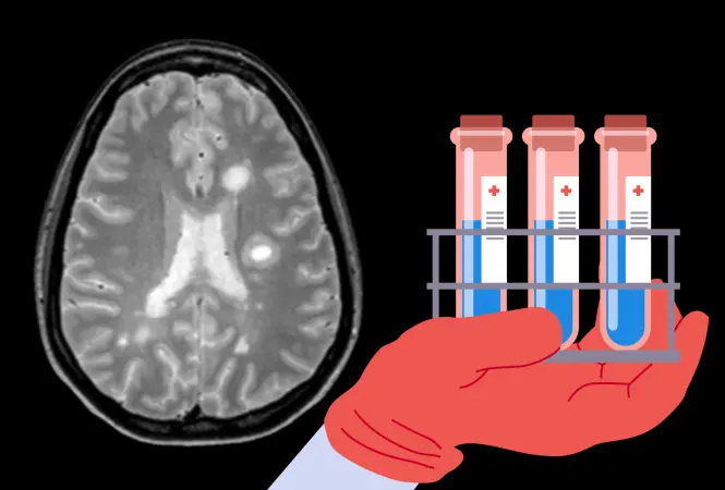 Neue diagnostische Marker für Multiple Sklerose