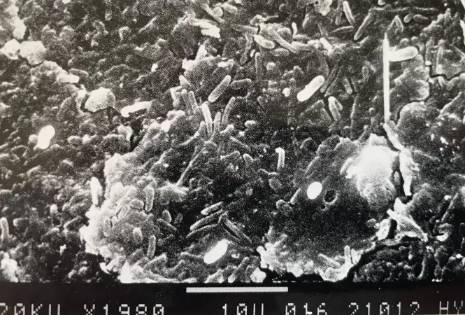 Biofilme – tückische Reservoire für Gram-negative Errege