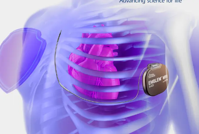 S-ICD: Effiziente Versorgung in der Kardiologie