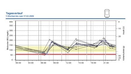 Abb. 2: Im Vergleich dazu: Eine Grafische Auswertung des Blutzuckerverlaufs mit...