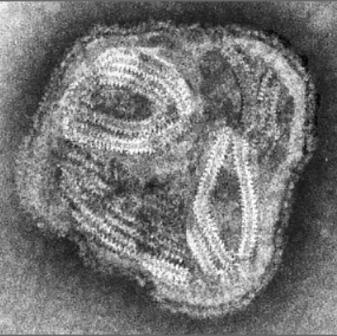 Elektronenmikroskopische Aufnahme eines Respiratorischen Synzytial-Virus (RSV)...