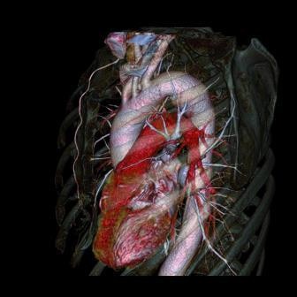 Erfassung von Herz, Aorta und Lunge in nur einer Sekunde.