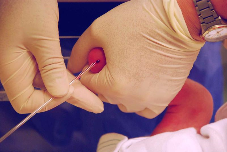 Nur wenige Tropfen Blut aus der Ferse eines Neugeborenen werden reichen aus, um...