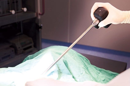 Drahtloses Endoskop (Foto: Fraunhofer IPA)