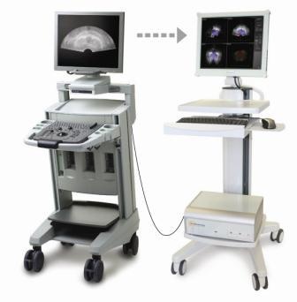 Ultraschallrohdaten werden vom BK-Medical Ultraschallgerät an das...