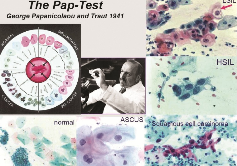 Der Erfinder des Pap-Tests George Papanicolaou