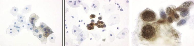 Die gefärbten Zellen werden anhand morphologischer Kriterien oder eines...