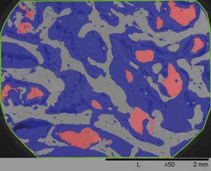 Abb. 2 a: Nach 12 Wochen: 21 % neu gebildete Knochensubstanz bei AttraX Putty....