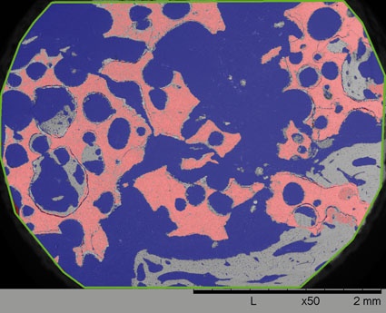 Abb. 2 b: 12 % neu gebildete Knochensubstanz bei Silikat-HA. Grau =...