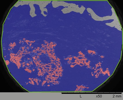 Abb. 2 c: nur 9 % neu gebildete Knochensubstanz im β-TCPPräparat....