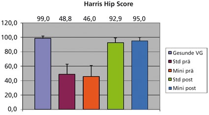 Abb. 2: Ergebnisse für den HarrisHipScore.