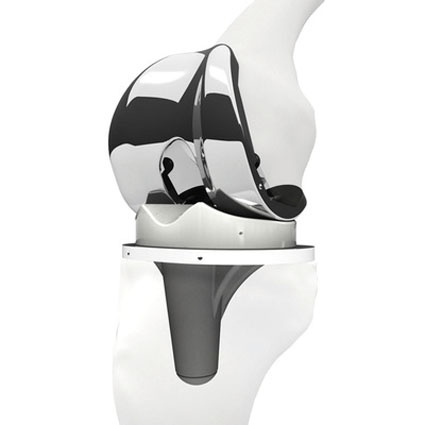 Abb. 2: Knie-Endoprothese aus Titan