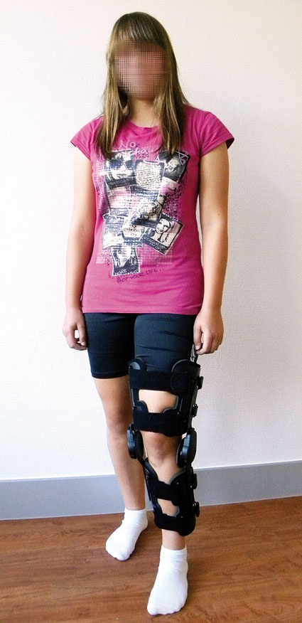 Abb. 2: Nach Kreuzbandoperation bei Kindern ist eine Knieorthese sinnvoll...