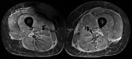 Abbildung A, Legende siehe Haupttext (Foto: Universitätsklinikum Heidelberg).