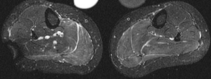 Abbildung B, Legende siehe Haupttext (Foto: Universitätsklinikum Heidelberg).
