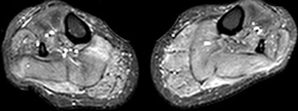 Abbildung Ac Legende siehe Haupttext (Foto: Universitätsklinikum Heidelberg).