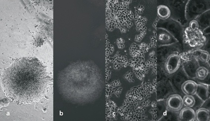 Abb. 3: Zellkulturbilder: Übersichtsbilder (1,25x) einer GFP-markierten...