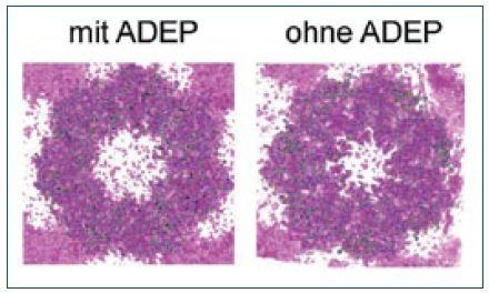 Abb. 1: Die Bindung von ADEP an die ClpP-Peptidase öffnet deren zentrale...