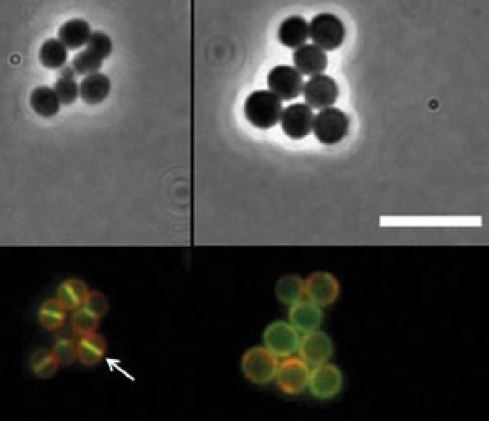 Abb. 2: In Gegenwart von ADEP verdaut ClpP u.a. ein Protein, FtsZ genannt,...