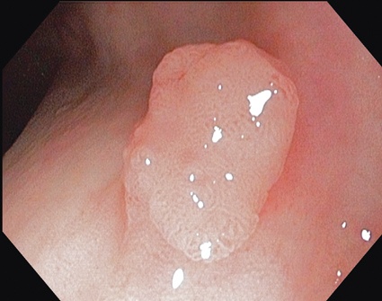 Abb. 2: Konventionellen Darstellung, siehe Abb. 1 (Foto: Olympus).