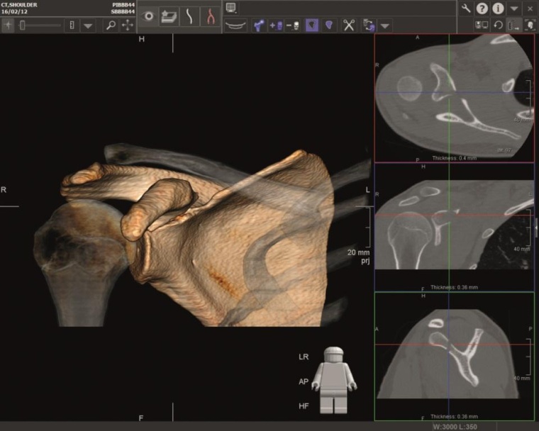 IMPAX 3D Software – unerlässlich bei der Befundung