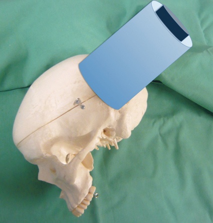 Schematische Darstellung an einem Kunststoffschädel des Menschen angebrachten...