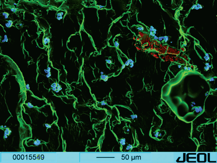 Abb. 1: REM-Aufnahme in Fehlfarben von polymerisiertem Palacos R+G, aus...