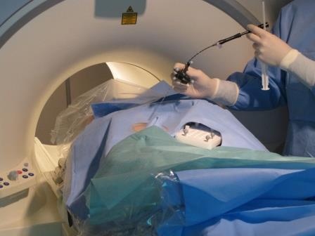 Einführung eines MR-kompatiblen Applikators bei einer MRT-geführten...