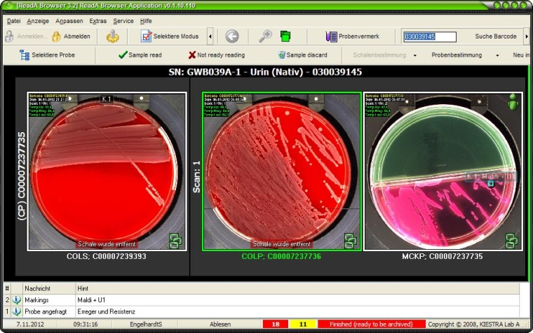 Abb. 2: Urinkulturplatten im ReadA-Browser von Kiestra. Agarplatten werden...