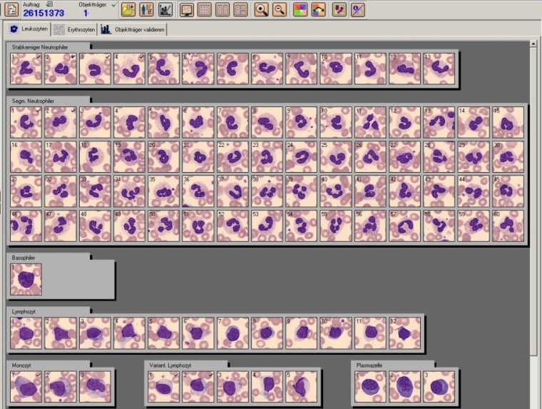 Abb. 1: Beispiel für die digitalisierte computergestützte Mikroskopie