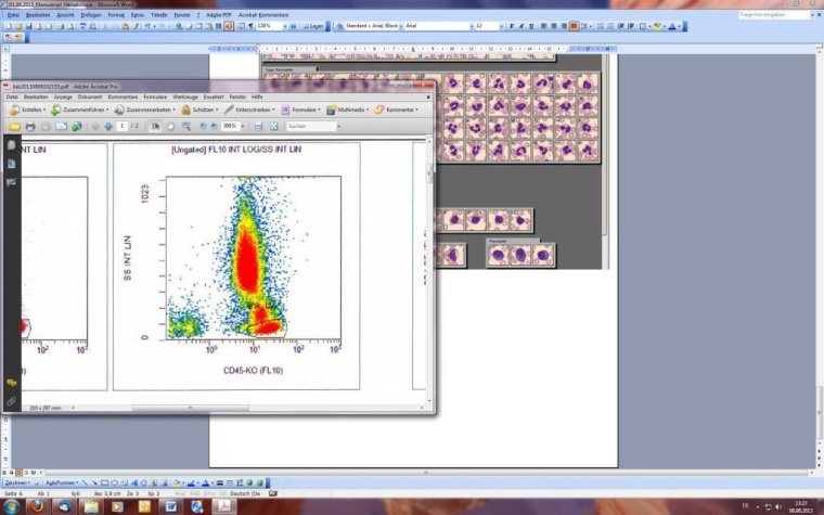 Abb. 2: Immunphänotypisierung mittels Durchflusszytometrie  (Scattergramm)