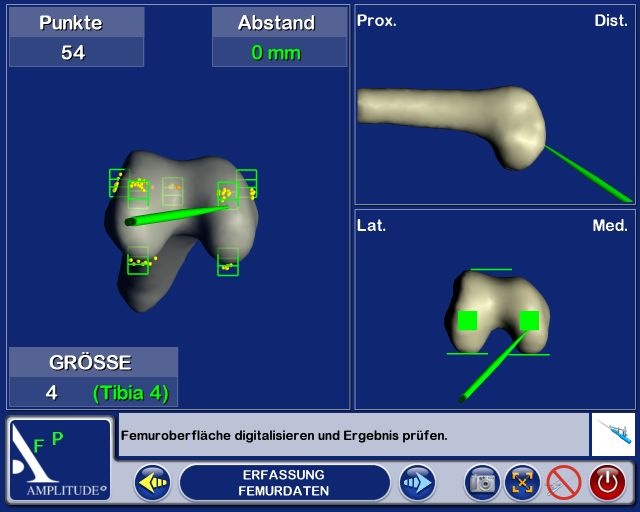 Abb. 2a: Digitalisierung Tibia und Femur