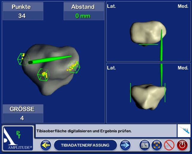 Abb. 2b: Digitalisierung Tibia und Femur