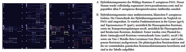 Abb. 1: Hybridisierungsmuster von Wildtyp P. aeruginosa PAO1 und einem...