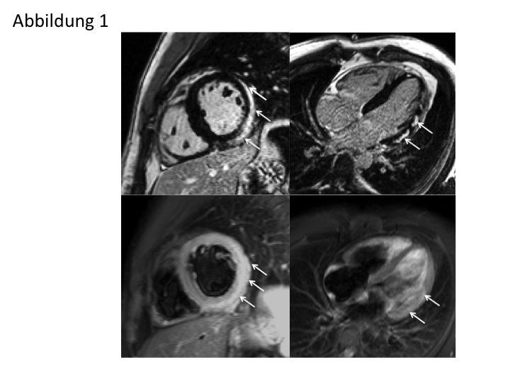 Abb. 1: 29-jähriger Patient mit Infekt der oberen Atemwege, weiteres siehe...